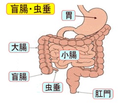 原因 虫垂炎 急性虫垂炎（盲腸）の症状・原因・治療方法について